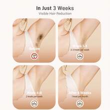 At-Home Hair Removal Laser For Women And Men Permanent Laser Hair Removal 999900 Flashes With 9 Energy Levels Hair Removal For Face Bikini Line Armpit Leg Back