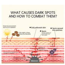 Vita A 视网膜紧致增强剂 | 含脂质体视网膜、Matryxyl、毛孔最小化剂、皱纹和细纹、紧致肌肤，15ml - 彩色 - 查看 10