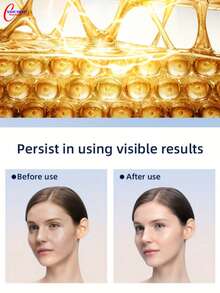 胶原蛋白美容仪 1 件，升级版美容仪，3 种工作模式，22 种能量引导，震动、按摩、激活胶原蛋白、促进营养吸收、改善鱼尾纹、眼纹、抬头纹、鼻唇沟纹，500mAh USB 充电电池，手持便携。是母亲节、情人节、感恩节以及女性朋友和母亲生日的完美礼物。