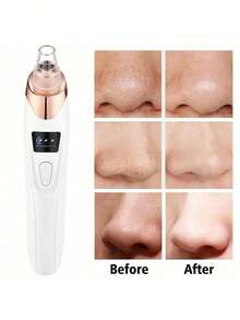 AXH Rechargeable Blackhead Remover, 400mAh Lithium Battery, Multi-Functional Facial Care Tool, Suitable For Skin Cleansing - White - View 8