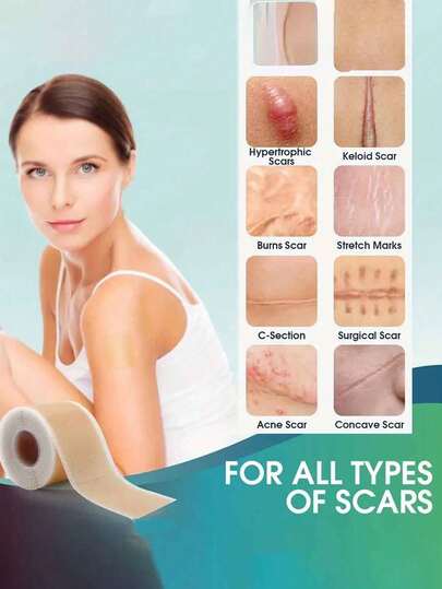 可重复使用的硅胶疤痕贴 - 有效遮盖剖腹产疤痕、痤疮疤痕、烧伤疤痕、手术疤痕和妊娠纹 - 柔滑保湿的浅米色配方，改善疤痕 | 弹性贴合 | 多用途护肤，隐形硅胶疤痕遮盖胶带，适用于手术疤痕、烧伤疤痕、产后疤痕，无香型，必备个人护理用品，纹身配件