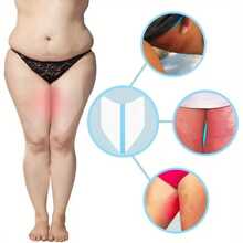 Ultra-Thin Anti-Friction Thigh Pad - Disposable Self-Adhesive Anti-Friction Tape, Breathable Thigh Skin Lift Patch, Suitable For Body And Legs, Relieves Friction On The Inner Thighs Of Men And Women, Relieves Friction, Breathable Adhesive, Comfortable To Wear