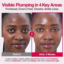 Niacinamide Capsule Cream - Double Gloss Moisturizer - For Use After Spot Treatment - Texture And Moisturizing - Korean Skincare