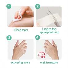 4 * 150cm Silicone Scar Camouflage Patch, Silicone Gel Scar Hiding Tape For Daily Care, Khaki Color