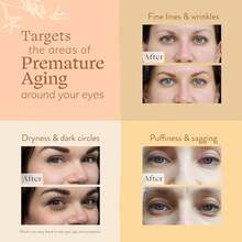 视黄醇脂质体+发酵大豆提取物眼霜，抗皱，抗衰老，改善肌肤弹性，淡化色素沉着，提亮肤色，蕴含视黄醇 - 彩色 - 查看 3