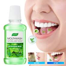 1 Bottle Mint Mouthwash, Oral Care, Freshens Breath, Cleans Teeth, Refreshing Mint Flavor, Gentle & Comfortable, Mouthwash, Cooling & Soothing, Self-Care, Deep Cleans Odor, Dental Care, Pleasantly Refreshing. - Multicolor - View 1