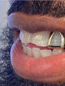 4pcs/2pcs/1PC Hallowmas Teeth Jewelry Hip Hop Simple And Fashionable 14K Gold Plating Hollowed-Out Teeth Copper Material Has A Smooth Surface Grillz Gold Grills For Teeth Grills For Teeth Women&Grills For Teeth Men Jewelry