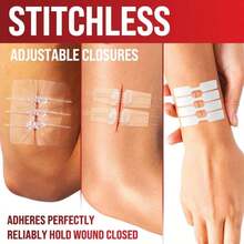 Emergency Wound Closure Strips - 24pk - 3 Types Easy To Use Butterfly Bandages - Stitchless &Amp; Painless Laceration Closure Kit - Mix Pack - View 3
