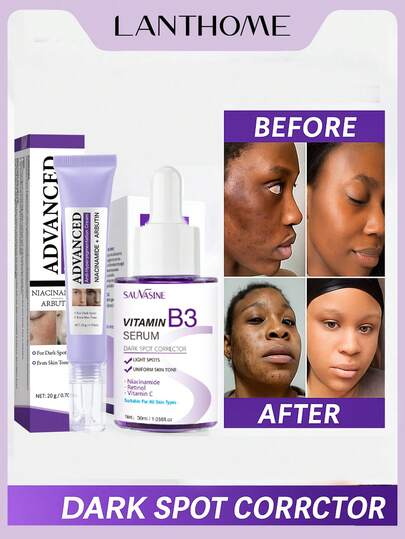 LANTHOME 30ml 维生素B3+20g 高级抗色素沉着霜 祛斑 面部和身体精华：老年斑 晒斑 雀斑 黄褐斑 褐斑 色素沉着治疗 | 延缓皮肤衰老，减少皱纹和细纹，使皮肤看起来更年轻、更紧致。深层补水，锁住水分，持久保湿 亮肤精华，适用于敏感、不均匀的肌肤