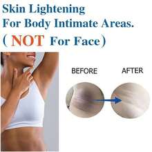 Skin Bleaching Cream For Women - Intimate Skin Care Lightening Cream For Intimate Areas, Private Parts, Underarms, Knees, Elbows, Inner Thighs, Bikini Areas–Dark Spot Remover For Face - trắng - Xem 4