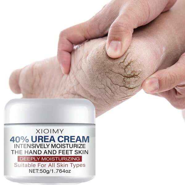 Xioimy XIOIMY Crema de pies de 50g, Mantequilla de pies hidratante con urea y ácido salicílico, suaviza la piel, hidratación profunda para la piel seca de manos, pies y Body para mujeres y hombres