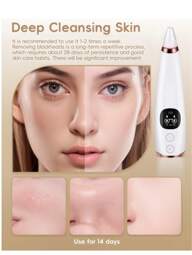Blackhead Remover Vacuum Cleaner - 3 Suction Levels, USB Powered Facial Pore Cleansing Kit - 6 Nozzles, Portable Electric Blackhead Extractor, An Ideal Gift For Men And Women