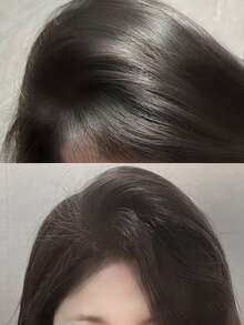 L'Oreal 欧莱雅专业美发【旅行装】舒缓头皮系列高级抗头皮不适平衡洗发露，100毫升 / 专业头皮平衡 / 这款轻盈的啫喱温和清洁，同时舒缓镇静敏感头皮。令秀发柔软、亮泽、水润。/ 富含烟酰胺，一种维生素B3衍生物，以其调节和舒缓功效而闻名。 - Scalp Advanced 100ml - 查看 8