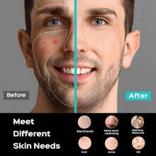 FjcFacial Cleansing Brush Face Scrubber : Portable Silicone Waterproof Rechargeable Face Wash Brush 5 Cleansing Modes Electric Deep Cleaning For Men Women Removing Blackhead Exfoliatingyq - 灰色 - 查看 7