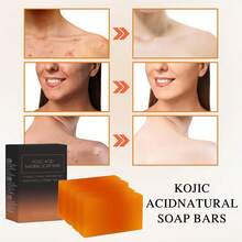 4 件装香皂套装，含维生素 C 和 E、视黄醇、胶原蛋白、姜黄 - 注入透明质酸、乳木果油、卡斯蒂利亚橄榄油、手工制作的面部和身体清洁复合物 - 4pcs曲酸皂 - 查看 6