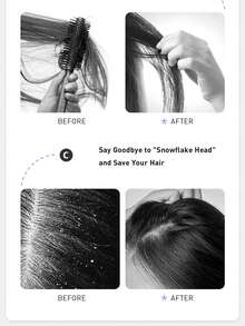 Kérastase 80毫升 SYMBIOSE 净澈去屑洗发露，蕴含水杨酸，适用于油性头皮和头屑，恢复头皮水分平衡，令秀发柔软亮泽，适合油性、易起屑发质日常使用。 - Purifying Anti-dandruff - 查看 7