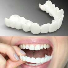1 Set, Dentures - Perforated Teeth Cover+Heart-Shaped Box Without Printing+Upper And Lower Teeth+2 Strips Of Eucommia Ulmoides Gum, Comfortable And Fitting Dental Veneer, Flexible White Plastic Teeth Cover For Men And Women, Upper And Lower Teeth Cover Accessories, Aesthetic Teeth Cover | Comfortable And Fitting Veneer | Durable Plastic, Dental Supplies - White - View 2
