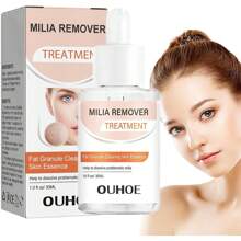 Anloximt 去除粟丘疹 30 毫升保湿粟丘疹去除剂脂肪颗粒修复粟丘疹去除眼下有助于溶解和减少眼周粟丘疹，学校背包