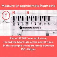 NetHong ECG/EKG 7 Step Ruler Card For ECG/EKG Interpretation Portable ECG EKG Card Ruler - Transparent - View 5