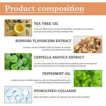 Anloximt 去除粟丘疹 30 毫升保湿粟丘疹去除剂脂肪颗粒修复粟丘疹去除眼下有助于溶解和减少眼周粟丘疹，学校背包