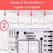 NetHong ECG/EKG 7 Step Ruler Card For ECG/EKG Interpretation Portable ECG EKG Card Ruler - Transparent - View 6