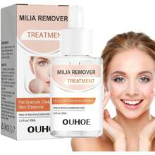 Anloximt 去除粟丘疹 30 毫升保湿粟丘疹去除剂脂肪颗粒修复粟丘疹去除眼下有助于溶解和减少眼周粟丘疹，学校背包