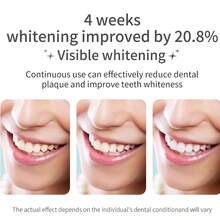 Electric Toothbrush With 4 Brush Heads, Rechargeable Electric Brush, Water Toothbrush For Teeth Cleaning And Gum Health - Black-1 - 查看 4