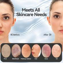 Facial Cleansing Brush Silicone Face Scrubber With Heat And Vibration 5 Speeds Waterproof Rechargeable Electric Face Scrub Brush For Men Women Deep Cleansing Exfoliating And Massage Purple