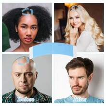 M60 Pcs Wig Tape Double Sided SelfAdhesive Toupee Tape Strong Hold Hair Extension Tapes Wig Accories Tapes Replacement For Women Men Wigs Lace Hairpieces Blue 8001 - as pic - View 4