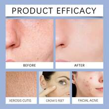 70pcs Day & Night Cleansing Cotton Pads, Containing AHA And BHA, Deep Pore Cleansing, Highly Moisturizing, Soothing And Repairing Skin, Pore Minimizing - Multicolor - View 10