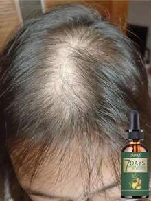 Say Goodbye To Baldness With Our Hair Treatment For Ultimate Thickness And Smoothness  Achieve Full Hair Volume That Stays Flexible And Never Feels Rough  Perfect Solution For Thinning Hair To Regain Confidence With Lush Voluminous Locks Every Day - 彩色 - 查看 2