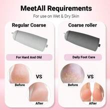 Electric Foot File, Foot Callus Remover, Equipped With Two Different Grinding Heads, Two Speed Settings, Automatic Lighting, For Better Removal Of Foot Calluses The First Choice For Giving Gifts, Perfect For Loved Ones, Mothers, And Elders. - 白色 - 查看 6