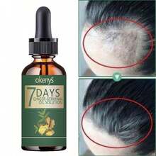 Say Goodbye To Baldness With Our Hair Treatment For Ultimate Thickness And Smoothness  Achieve Full Hair Volume That Stays Flexible And Never Feels Rough  Perfect Solution For Thinning Hair To Regain Confidence With Lush Voluminous Locks Every Day - 彩色 - 查看 6