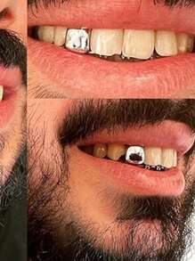 4pcs Grillz Gold Tooth Cap Grillz Teeth Men Gold Teeth Grills For Your Teeth 14K Gold/Silver Plated Single Grillz For Women Gold Jewelry Hip Hop Rapper Costume