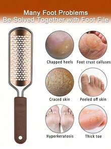 Lima para os pés, esfoliante para os pés, pedicure - removedor de calos para os pés, ralador profissional, raspador para os pés, removedor de calos, removedor de pele morta e rachada para pés secos e molhados - Multicolorido - Ver 8