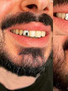 4pcs Grillz Gold Tooth Cap Grillz Teeth Men Gold Teeth Grills For Your Teeth 14K Gold/Silver Plated Single Grillz For Women Gold Jewelry Hip Hop Rapper Costume