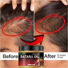 Buy One Get One Free 4.3oz Batana Hair Oil, Pure Honduran Batana Fruit Extract Vegetable Oil, Helps To Strengthen Hair Roots, Eliminate Split Ends, Long-Lasting Anti-Frizz, Light And Non-Greasy Texture, Nourishes Hair, Improves Curls, Makes Hair Thicker, Tougher And Healthier. Unisex