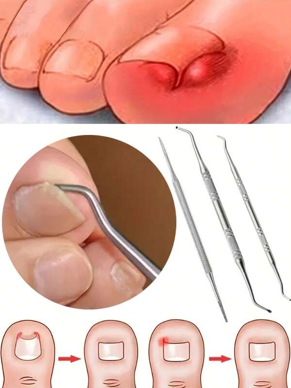 3 piezas Juego de Herramientas de Acero Inoxidable para Uñas - Limas de Uñas de Doble Cara, Elevadores, Cucharas y Varillas Empujadoras para Limpiar y Retirar Uñas de los Pies, Bolsas y Almacenamiento, Ayudando a Manos y Pies a Recuperarse Mejor. Herramientas de Cuidado de Manos y Pies, Herramientas de Limpieza, Regalos de Halloween, Regalos de Navidad, Esenciales para Familias, Son un Gran Regalo