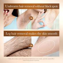 Bộ sản phẩm tẩy lông bằng gạo 2 món/hộp gồm kem tẩy lông và gel làm dịu da, tẩy lông nhanh chóng và nhẹ nhàng, giúp giảm sự phát triển của lông, phục hồi nang lông, dưỡng ẩm cho da khô, cho làn da mịn màng, mềm mại và nhạy cảm khi sử dụng hàng ngày. - Nhiều màu - Xem 10