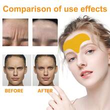 Eelhoe Forehead Wrinkle Patch Anti Wrinkle Pad Forehead Skin Massage Reduce Fine Lines Wrinkles Smooth Out Skin Texture On Your Forehead Forehead Care Patch - 黃色 - 查看 6