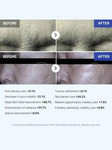Medicube ONE DAY EXOSOME SHOT PORE AMPOULE 2000，安瓶精华质地，轻盈易吸收，密集护理，日常护理，紧急修复，韩妆，韩国彩妆，30毫升/1.01液体盎司。