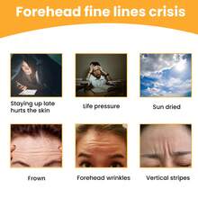 Eelhoe Forehead Wrinkle Patch Anti Wrinkle Pad Forehead Skin Massage Reduce Fine Lines Wrinkles Smooth Out Skin Texture On Your Forehead Forehead Care Patch - 黃色 - 查看 9