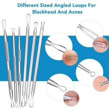 15-Piece Acne Blackhead Removal Kit (With Storage Box), Professional Stainless Steel Cleaner, Blackhead Pore Cleaner, Nose And Face Acne Removal Tool Set, Comprehensive Solution To Blackhead Problems, Face Cleaning Tools - 彩色 - 查看 6