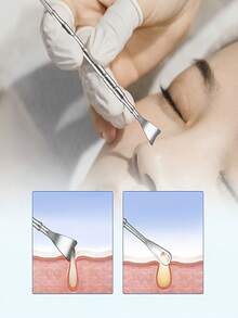 2件/4件装不锈钢双头黑头导出工具 - 专业双头导出器，符合人体工学的手柄，适用于挤压白头、黑头、粉刺和面部清洁。无需电池，便携式设计，耐用材质，易于清洁，是美容爱好者的必备品，专为护肤而设计。 - 銀色 - 查看 9