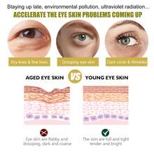 24k 金眼膜淡化细纹黑眼圈补水保湿紧致眼部肌肤眼膜，完美的生日礼物，增强您的美容解决方案，恢复眼部活力，卓越的皮肤护理解决方案，专为每一位女性设计。 - 彩色 - 查看 7