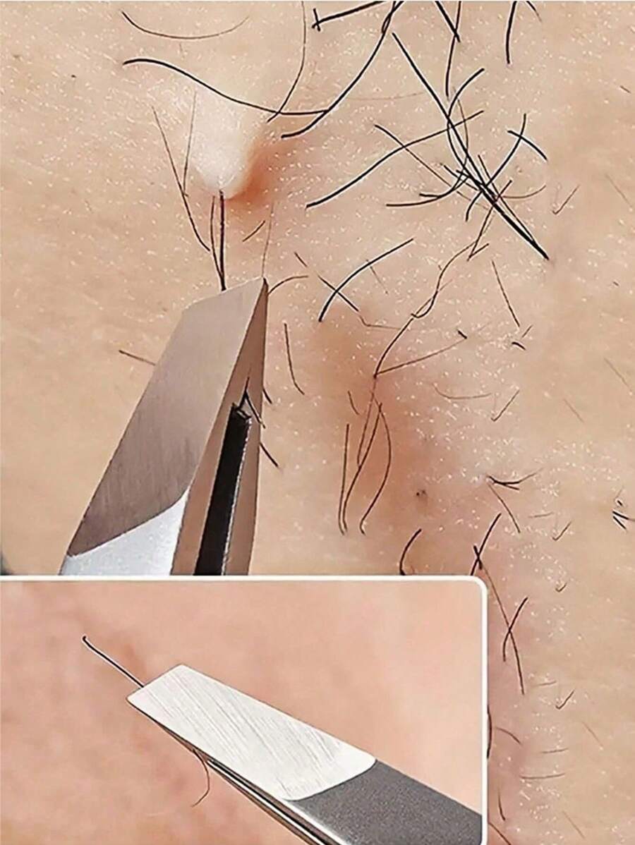 1/2 件专业不锈钢眉毛镊子，精准脱毛 - 适用于面部和内生毛发、碎屑和黑头，不含酒精，男女通用