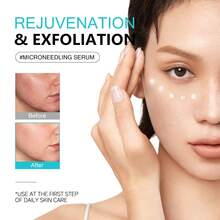 KOEC 100微针外泌体积雪草精华，保湿、去角质、丰盈肌肤，打造光泽肌肤，液体肌肤强化剂 - 綠色 - 查看 3