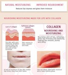 20pcs Hydrating Lip Sleeping Mask & 5 Moisturizing Gel Lip Masks With Hyaluronic Acid & Resveratrol – Deep Moisture For Chapped Skin With A Soft, Glossy Finish - 粉色 - 查看 8