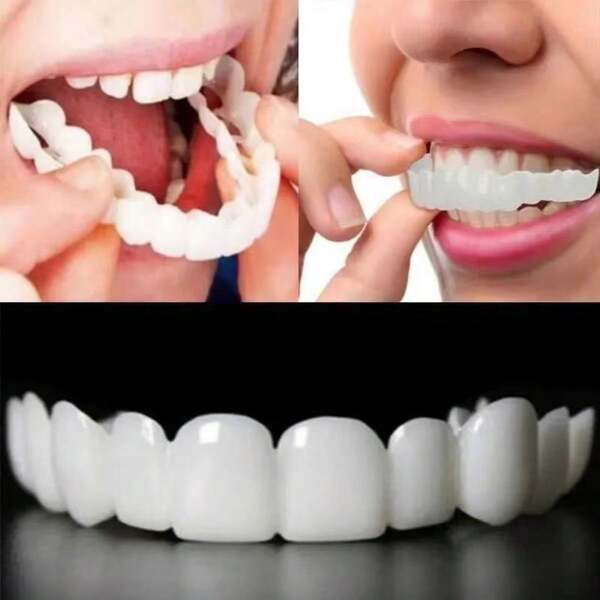 4pcs Smile Teeth Whitening Decoration Kit, 2nd Gen, Easy To Use