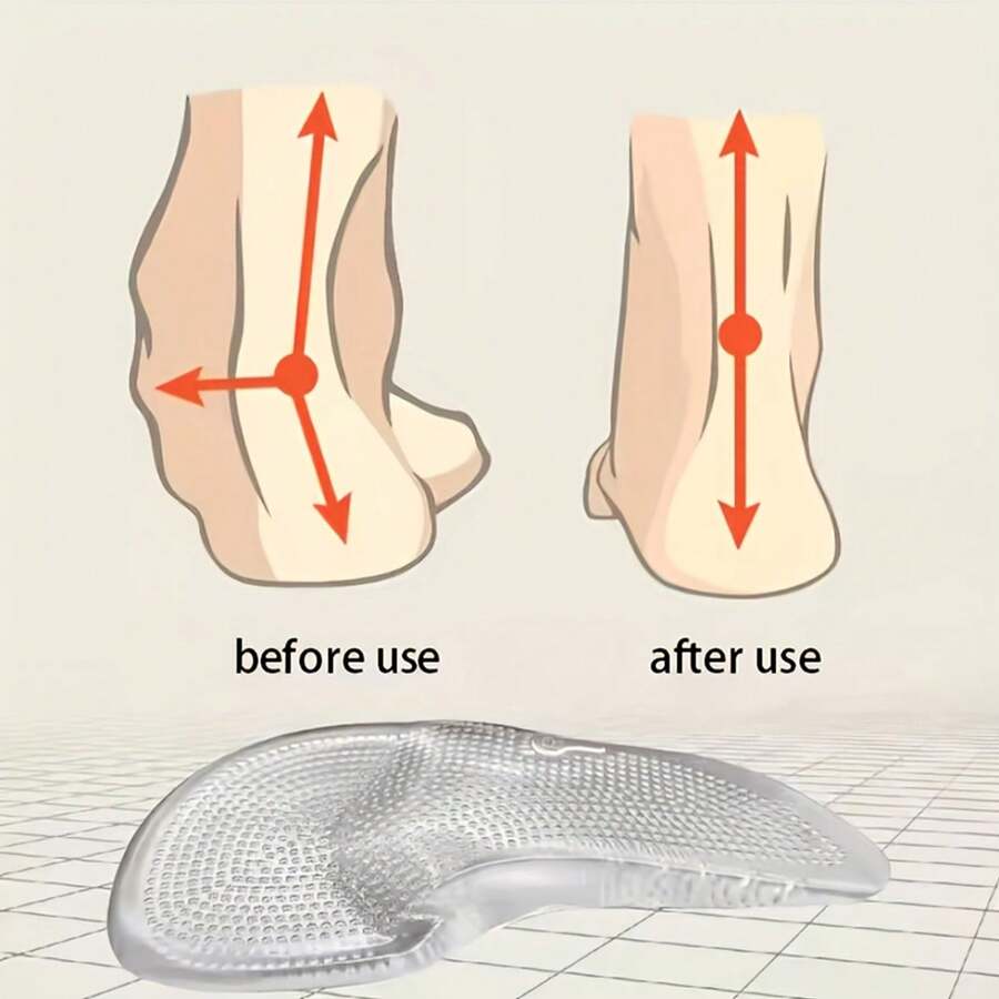 2 Pcs Transparent Silicone Forefoot Pads, Arch Support Sole Inserts, Non-Slip Shock Absorbing Soft Half Pad For Men Women Casual Shoes Heels - Clear - View 1